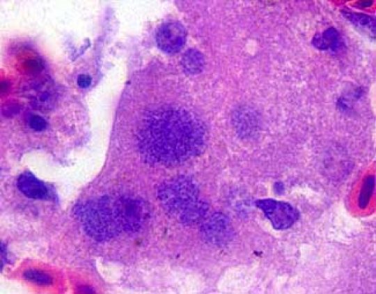 Chlamydophila psittaci in celulele ficatului